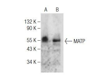 MATP Antibody (F-4) | SCBT - Santa Cruz Biotechnology
