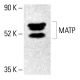 MATP Antibody (F-4) - Western Blotting - Image 413082