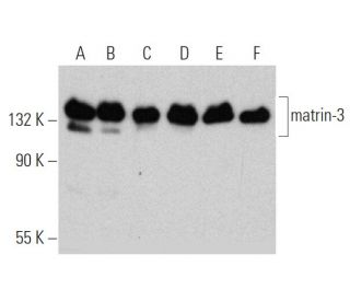 western blotting image from recommended matrin-3 (2539C3a) monoclonal antibody replacement. Image 368216