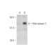 Matriptase-2 Antibody (H-1) - Western Blotting - Image 333654