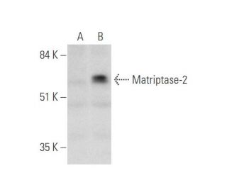 Matriptase-2 Antibody (H-1) - Western Blotting - Image 333654SAM Transcription Activation: SAM system utilizing dCas9-VP64, MS2-P65-HSF1, and sgRNA for precise gene transcription activation.