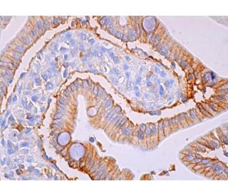 Matriptase Antibody (D-7) - Immunohistochemistry - Image 379126 
