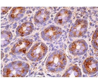 MAVS Antibody (E-3) | SCBT - Santa Cruz Biotechnology
