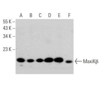 western blotting image from recommended MaxiKβ (A-5) monoclonal antibody replacement. Image 359402