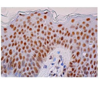 immunohistochemistry image from recommended MBD2 (C-11) monoclonal antibody replacement. Image 333317
