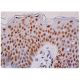 immunohistochemistry image from recommended MBD2 (C-11) monoclonal antibody replacement. Image 333317
