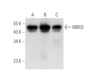 MBD2 Antibody (C-11) - Western Blotting - Image 314177
