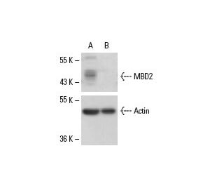 MBD2 siRNA (h): sc-35865. Western blot analysis of MBD2 expression in non-transfected control (A) and MBD2 siRNA transfect 