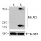 Anticorpo MBLAC2 (E-7): sc-398153. Análise Western blot da expressão de MBLAC2 em lisados celulares completos K-562 não tratados (A) e tratados quimicamente (B). β-Actina (C4): sc-47778 utilizado como controlo de carregamento. Reagente de deteção utilizado: m-IgG Fc BP-HRP: sc-525409. MBLAC2 Antibody (E-7) - Western Blotting - Image 415415