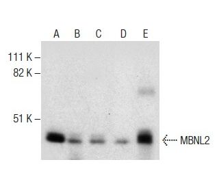 MBNL2 Antibody (3B4) - Western Blotting - Image 284348 