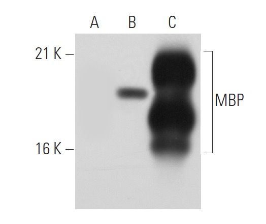 サルサ　1205050 MBP Antibody (201) | SCBT - Santa Cruz Biotechnology
