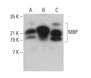 western blotting image from recommended MBP (F-6) monoclonal antibody replacement. Image 376550