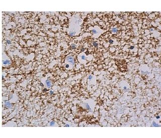 mbp-antibody-f-6-