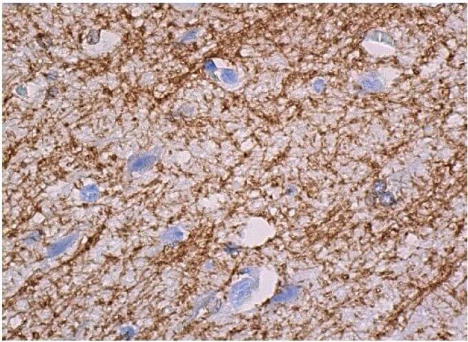 mbp-antibody-f-6-