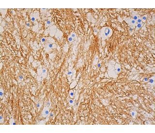 Anti-MBP Antibody (F-6) | SCBT - Santa Cruz Biotechnology