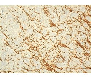 MBP Antibody (F-6) | SCBT - Santa Cruz Biotechnology