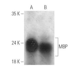 MBP抗体(F-6) | SCBT - Santa Cruz Biotechnology