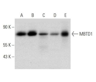 MBTD1 Antibody (H-6) - Western Blotting - Image 323788 