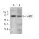 MBTD1 Antibody (H-6) - Western Blotting - Image 369945