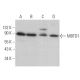 MBTD1 Antibody (H-6) - Western Blotting - Image 369952 