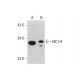 western blotting image from recommended MC1-R (578CT6.2.3) monoclonal antibody replacement. Image 384290