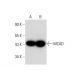 MCAD Antibody (G-4) - Western Blotting - Image 137793 