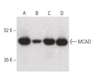 MCAD Antibody (H-7) - Western Blotting - Image 400380 