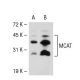 MCAT Antibody (3B5) - Western Blotting - Image 51590 
