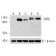 Anticuerpo MCC (A-9): sc-398216. Análisis Western blot de la expresión de MCC en lisados celulares completos de HeLa sin tratar (A), HeLa tratados químicamente (B, C, D) y HCT-116 (E). Reactivo de detección utilizado: m-IgG1 BP-HRP: sc-525408. β-Actina (C4): sc-47778 utilizada como control de carga. Reactivo de detección utilizado: m-IgG Fc BP-HRP: sc-525409. MCC Antibody (A-9) - Western Blotting - Image 415411