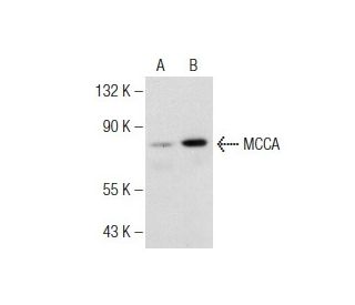 MCCA Antibody (B-7) - Western Blotting - Image 147220 