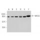 MCCA Antibody (D-11) - Western Blotting - Image 371663 
