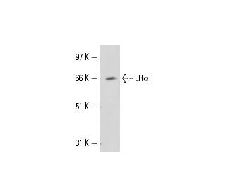 MCF7 nuclear extract: sc-2149. Western blot analysis of ER alpha expression...