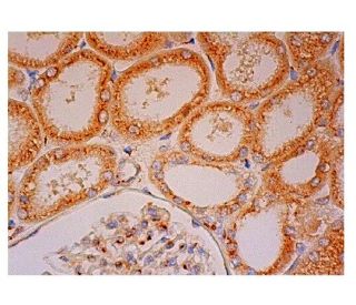 MCFD2 Antibody (F-3) - Immunohistochemistry - Image 302244 