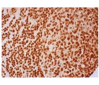 Mcl-1 Antibody (C-2) - Immunohistochemistry - Image 297182 