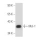 Mcl-1 Antibody (MCL-401) - Western Blotting - Image 15864 