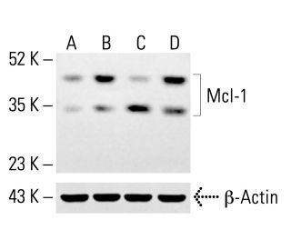 Mcl-1 Antibody (RC13) - Western Blotting - Image 413165