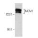 This polyclonal antibody has been discontinued. See our recommended <a href="mcm2-antibody-e-8">MCM2 (E-8)</a> monoclonal antibody (sample data shown). western blotting image from recommended MCM2 (E-8) monoclonal antibody replacement. Image 356630