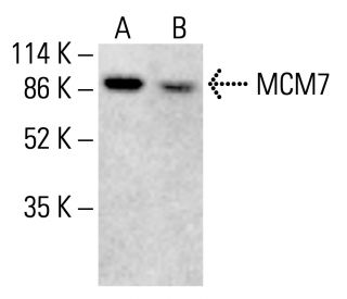 MCM7 Antibody (DCS-141) - Western Blotting - Image 412659