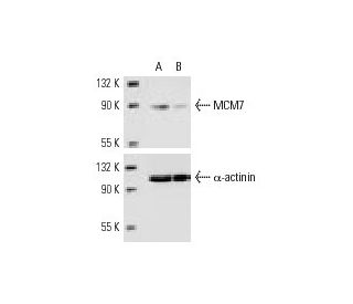 MCM7 siRNA (h): sc-35887. Western blot analysis of MCM7 expression in non-transfected control (A) and MCM7 siRNA transfect 