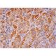 MCP-1 Antibody (1A7B8) - Immunohistochemistry - Image 293332