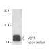 MCP-1 Antibody (1A7B8) - Western Blotting - Image 11368 