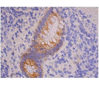 immunohistochemistry image from recommended MCP-1-4/eotaxin (B-2) monoclonal antibody replacement. Image 357536