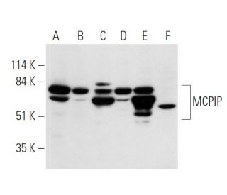 MCPIP Antibody (H-6) - Western Blotting - Image 376283 