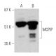 western blotting image from recommended MCPIP (H-6) monoclonal antibody replacement. Image 364948