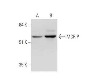 MCPIP Antibody (H-6) - Western Blotting - Image 344519The Double Nickase Plasmid features a U6 promoter for sgRNA expression, a 20 nt targeting sequence, and a gRNA scaffold to guide Cas9n. It includes a CBh promoter for Cas9n (D10A) and puromycin resistance, GFP for transfection verification, and nuclear localization signals (NLS). The 2A peptide allows co-expression of Cas9n and Puro from a single promoter, enabling precise genome editing with reduced off-target effects.