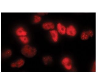 MCPyV large T-antigen抗体(CM2B4) | SCBT - Santa Cruz Biotechnology