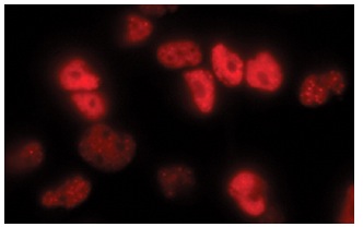 MCPyV large T-antigen Antibody (CM2B4): m-IgGκ BP-HRP Bundle