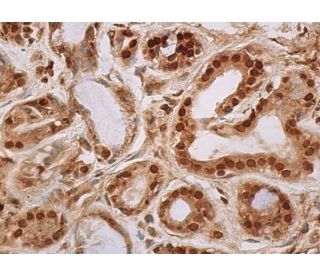 western blotting image from recommended MCR (H10E4C9F) monoclonal antibody replacement. Image 384626