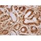 western blotting image from recommended MCR (H10E4C9F) monoclonal antibody replacement. Image 384626