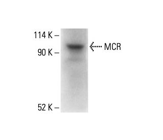 MCR Antibody (4i342) - Western Blotting - Image 411924SAM Transcription Activation: SAM system utilizing dCas9-VP64, MS2-P65-HSF1, and sgRNA for precise gene transcription activation.